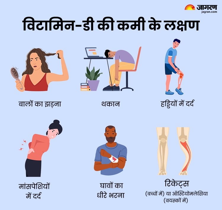 Vitamin D Deficiency